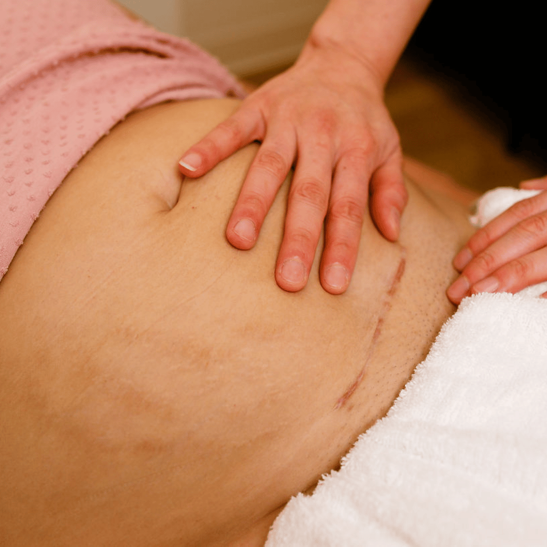 after c-section